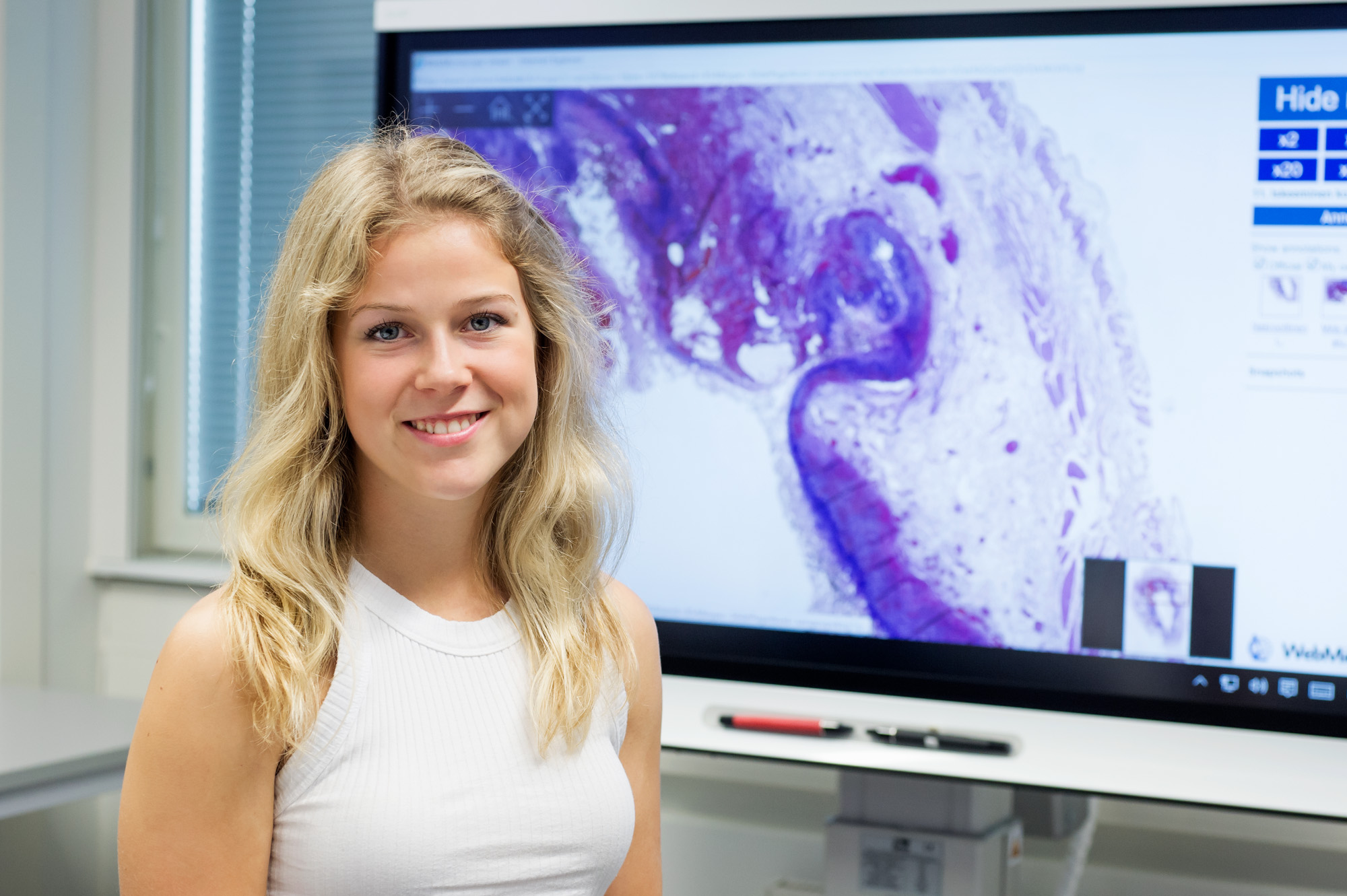 Lääketieteen opiskelija Paula Auvinen.