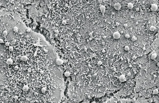 A microscopic photo of extracellular vesicles.