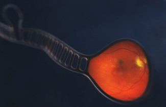 Kuvankäsittelyllä yhdistetty miRNA:n rakenne ja silmänpohjan ikärappeuman merkkejä silmässä. 