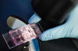 Researches studies tumour-environment interactions