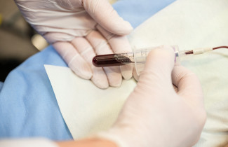 Blood sample.