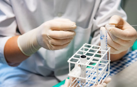 Koeputkia Aivotutkimusyksikössä.