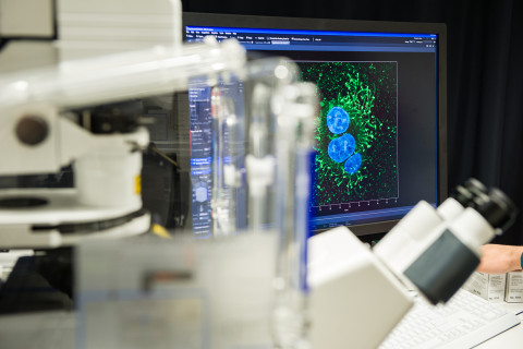 Image of extracellular vesicles on computer screen