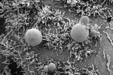 Syöpäsolun pinnalle tarttuneita vesikkeleitä pyyhkäisyelektronimikroskooppikuvassa. 