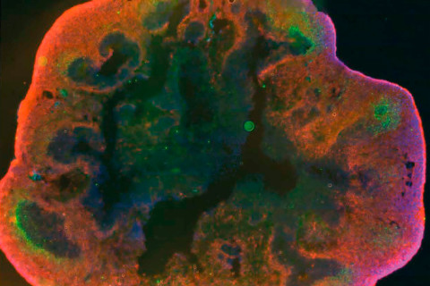 A microscopic image of a brain organoid.