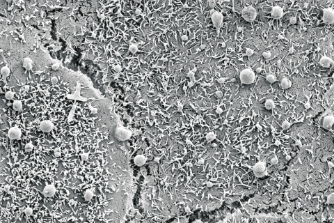 A microscopic photo of extracellular vesicles.