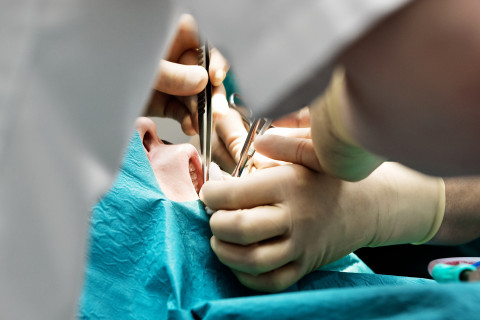 Suukirurginen leikkaus.