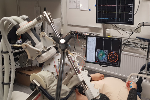 Transkraniaalinen magneettistimulaatiotutkimus EPM1-potilaalla. 