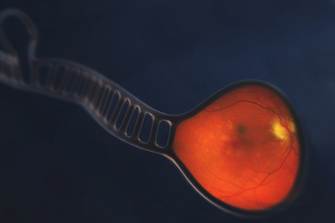 Kuvankäsittelyllä yhdistetty miRNA:n rakenne ja silmänpohjan ikärappeuman merkkejä silmässä. 