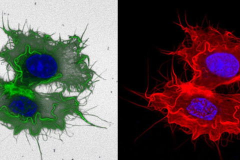 Pictures of cancer cells
