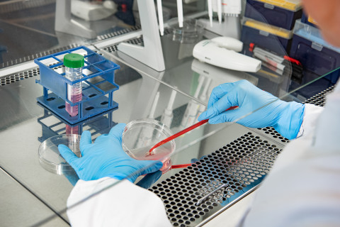 Potilasperäisiä soluja käsitellään laboratoriossa