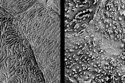 Suun limakalvon pintasolukkoa.