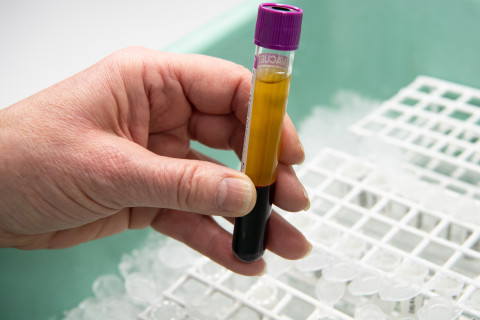Blood sample.