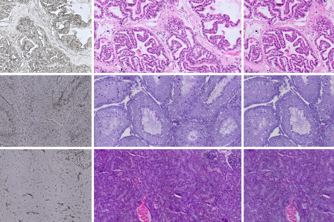 Vasemmalla värjäämätön kudos, keskellä kemiallisesti värjätty ja oikealla virtuaalivärjätty kudos. Ylärivillä eturauhanen, keskellä kives ja alhaalla munuainen. Kuva: Sonja Koivukoski.