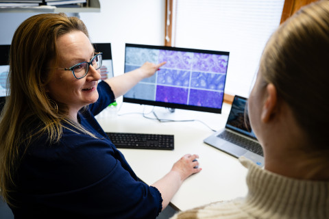 Leena Latosen tutkimusryhmä kehittää tekoälypohjaista virtuaalivärjäystä kudosnäytteille. Näytöllä vasemmalla kudosnäyte, keskellä näyte kemiallisesti värjättynä ja oikealla virtuaalivärjättynä.”Leena Latosen tutkimusryhmä kehittää tekoälypohjaista virtuaalivärjäystä kudosnäytteille. Näytöllä vasemmalla kudosnäyte, keskellä näyte kemiallisesti värjättynä ja oikealla virtuaalivärjättynä.