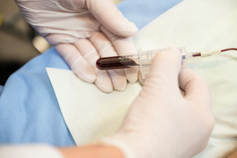 Blood sample.