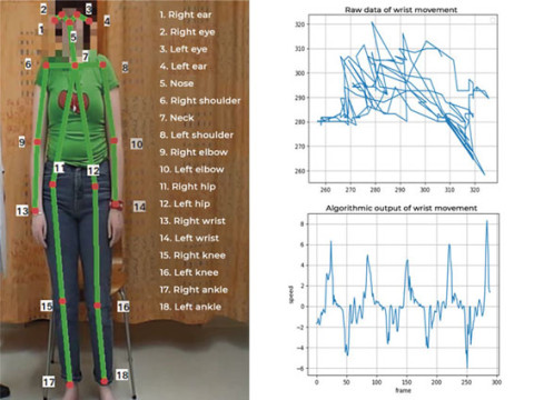 Mittauspisteet kehossa sekä ranteen liikettä kuvaava raakadata ja algoritmi. 