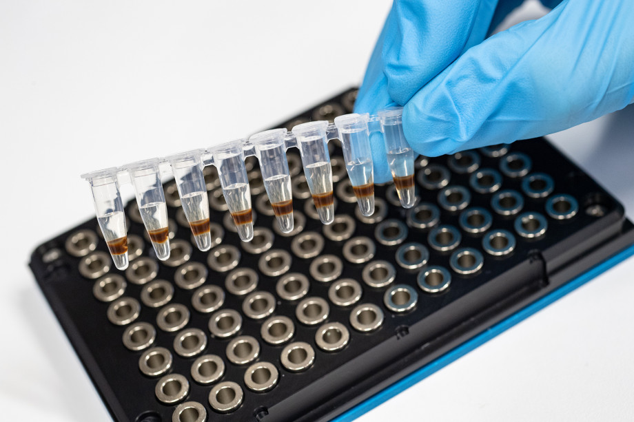New algorithm for the diagnostics of dementia