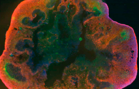 A microscopic image of a brain organoid.