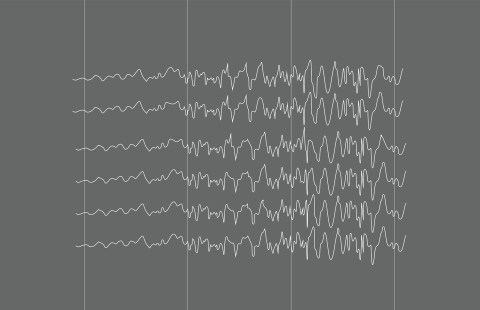 EEG pattern during epileptic seizure