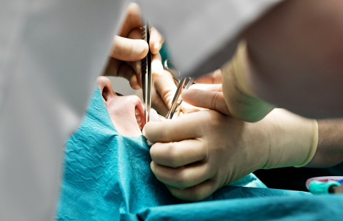 Suukirurginen leikkaus.