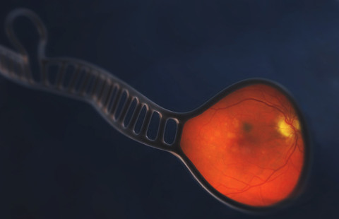 Kuvankäsittelyllä yhdistetty miRNA:n rakenne ja silmänpohjan ikärappeuman merkkejä silmässä. 