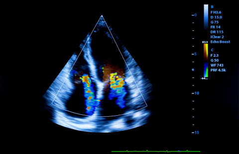 Human heart ultrasound image