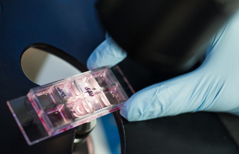 Specimen under microscope.