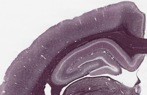 Myelin structures in the brain.