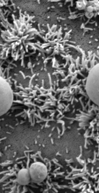 Syöpäsolun pinnalle tarttuneita vesikkeleitä pyyhkäisyelektronimikroskooppikuvassa. 
